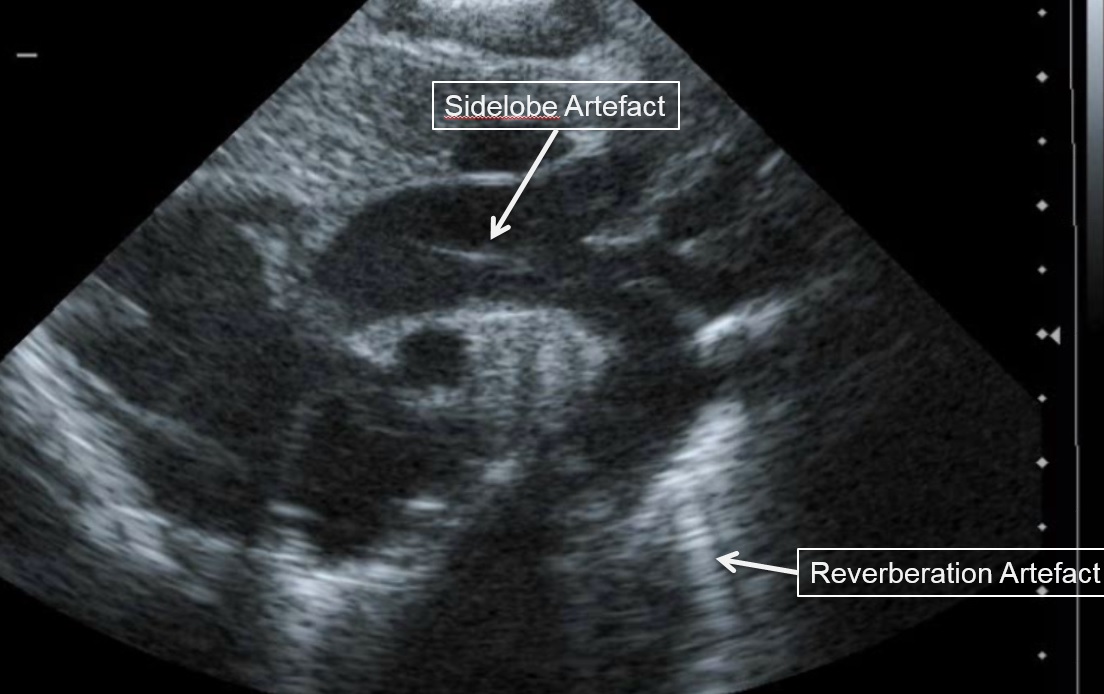 Pocus Physics Nicupocus